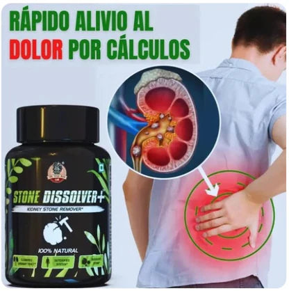 STONE DISSOLVER+ (Eliminador de calculos renales)